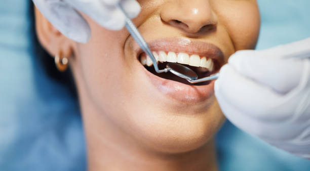 Best Emergency Dental Care for Broken or Chipped Teeth in Granite Falls, MN